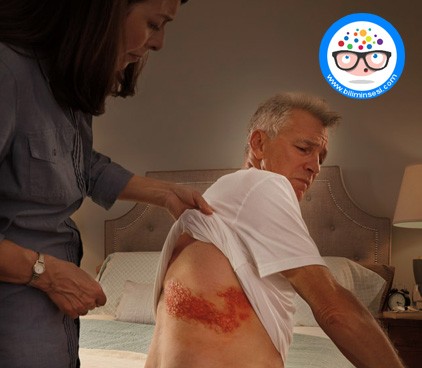 Zona hastalığı, Zona Nedir, Zona hastalığı tedavisi