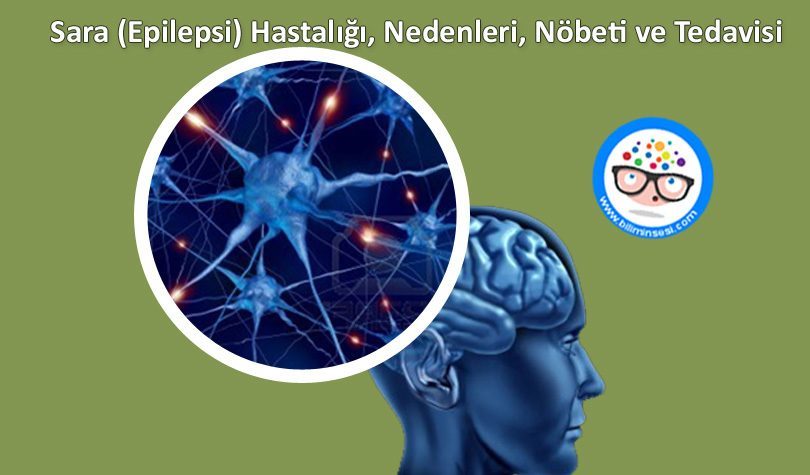 Sara (Epilepsi) Hastalığı Nedenleri? Nöbeti ve Tedavisi – BiliminSesi ...