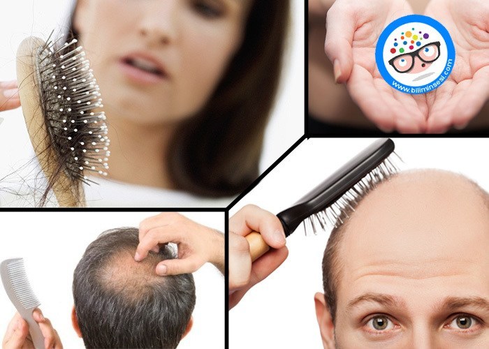 Saç Dökülmesi Nedenleri ve Tedavisi