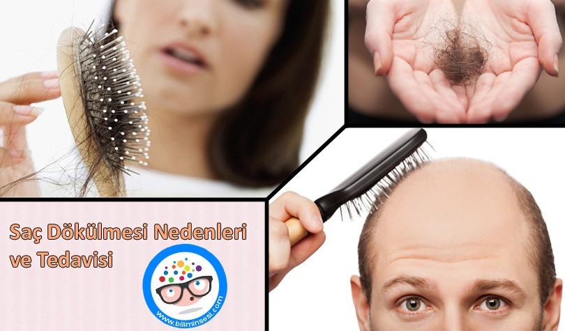 Saç Dökülmesi Nedenleri ve Tedavisi