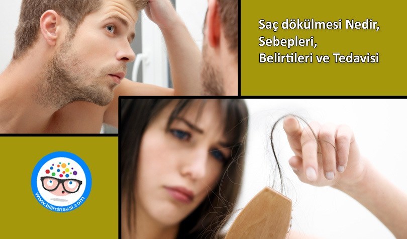 Saç dökülmesi Tedavisi