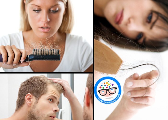 Saç dökülmesi Tedavisi