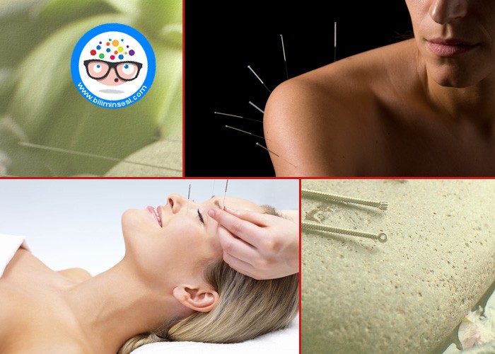 Akupunktur İle Depresyon Ve Bagimliliklarinizdan Kurtulun