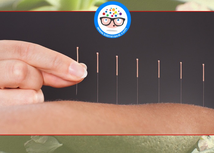 Akupunktur İle Depresyon Ve Bagimliliklarinizdan Kurtulun