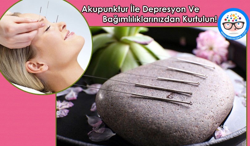 Akupunktur İle Depresyon Ve Bagimliliklarinizdan Kurtulun