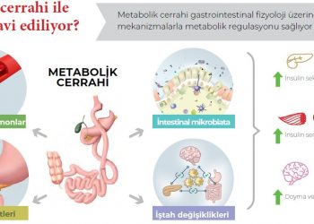 Obezite ve Diyabet Hastalıklarının Metabolik Cerrahi ile İle İlişkisi